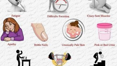 Penting!! 10 Tanda Kamu Kekurangan Zat Besi